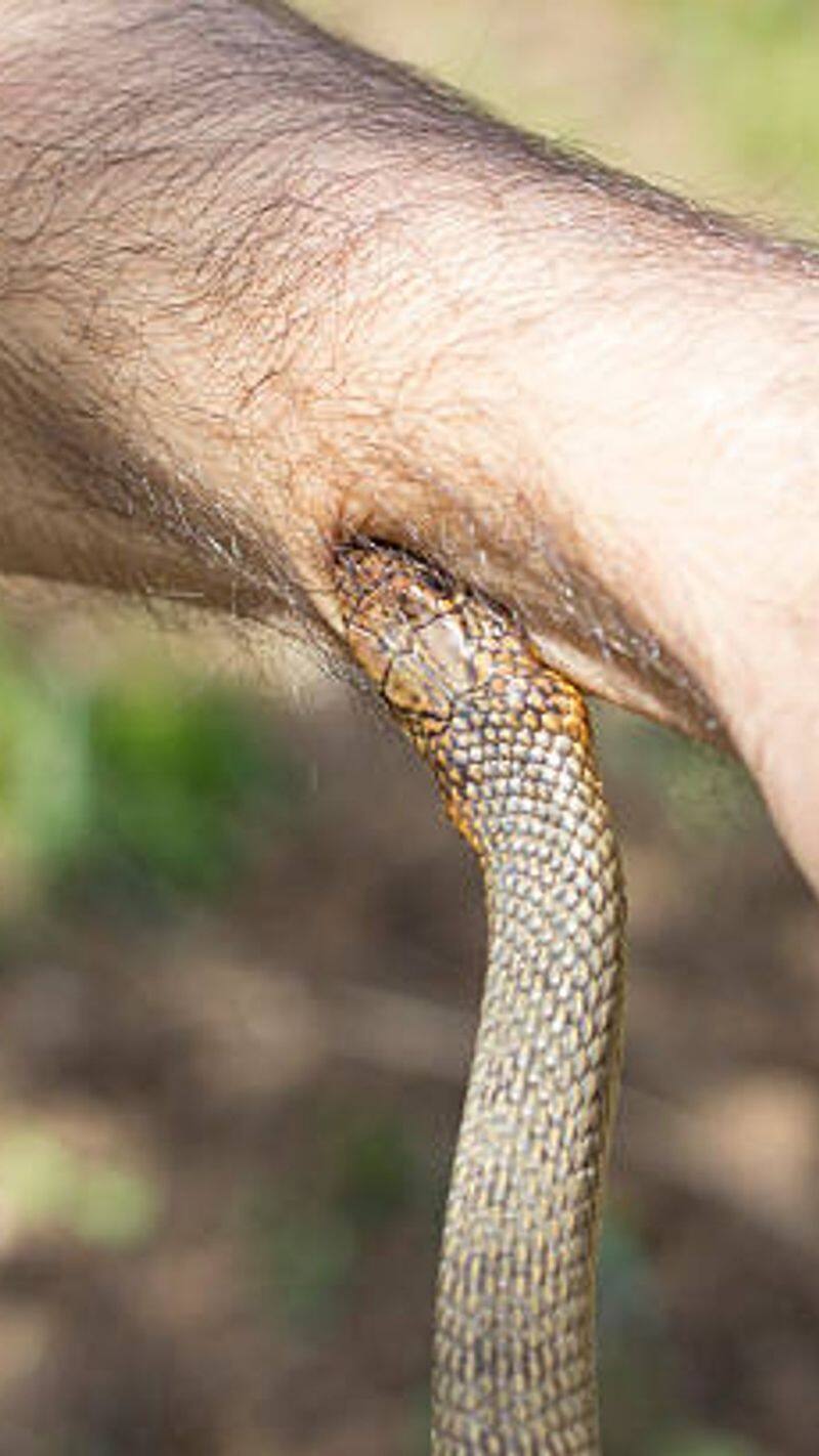 What to do in case of snake bite  10 important steps for first aid in case of snake bite  xsmn