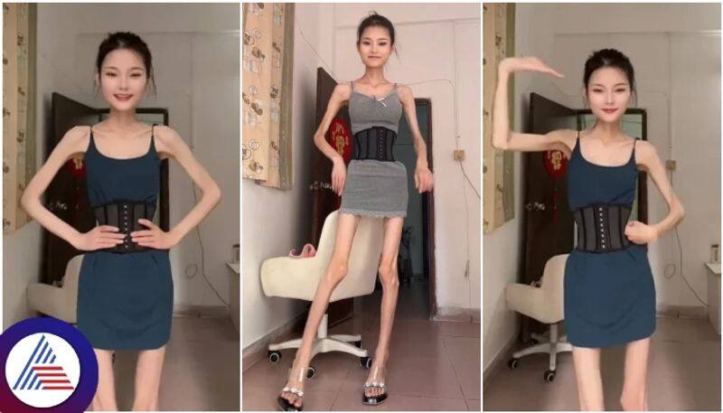 Beautiful young woman only 25 kilograms weighs and she look like world living skeleton sat