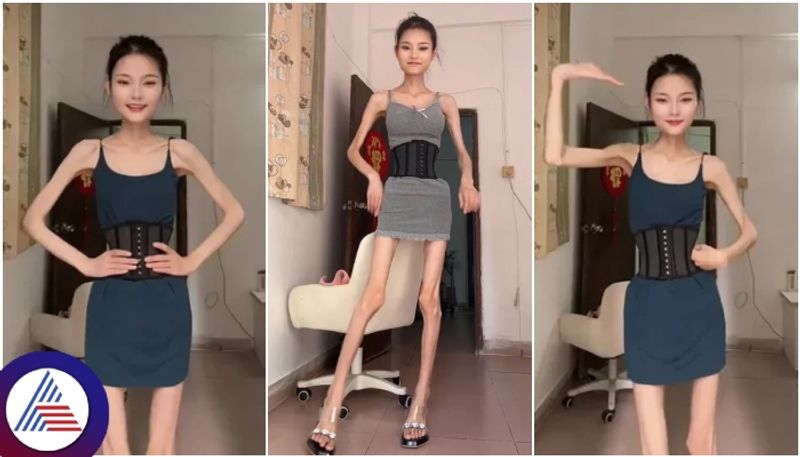 Beautiful young woman only 25 kilograms weighs and she look like world living skeleton sat