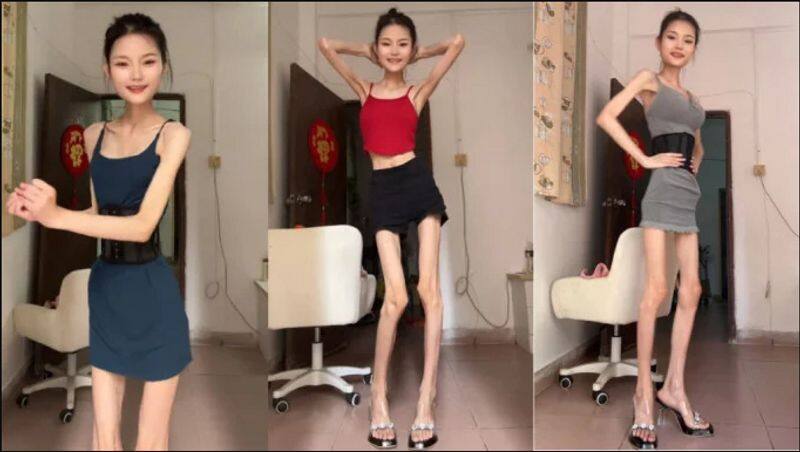 Beautiful young woman only 25 kilograms weighs and she look like world living skeleton sat