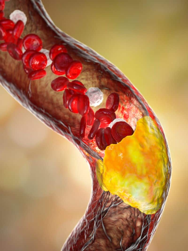 foods to lower your cholesterol levels