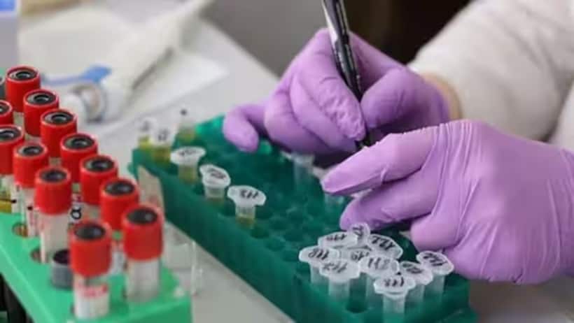Over 300 deadly virus samples go missing from Australian lab in ‘major biosecurity breach'