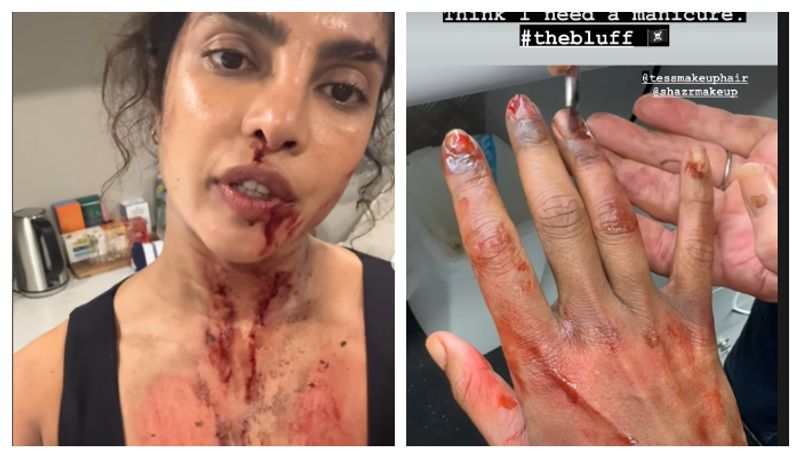 Did Priyanka Chopra INJURE her hand during the filming of her movie 'The Bluff'? Here's what we know ATG