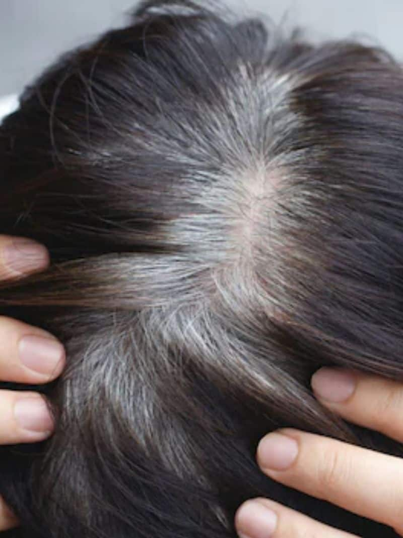 foods to get rid of Premature Greying of Hair 