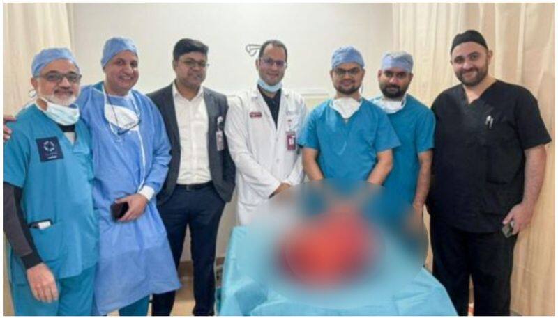 doctors removed tumour weighing nearly 16kg from a 63 year old patient 