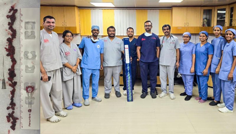 artificial intelligence based treatment for pulmonary embolism successfully completed at lizzy hospital