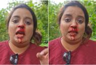  WATCH: Video of Pune woman punched in face in road rage incident goes viral NTI 