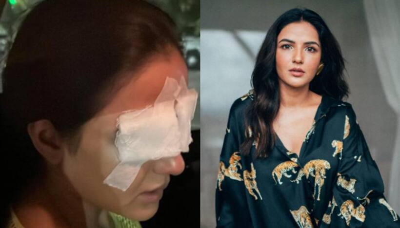 SHOCKING: Jasmine Bhasin's cornea gets damaged after she wears lens, undergoes treatment