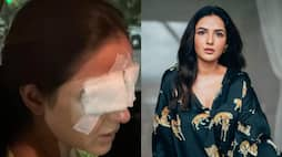 jasmin bhasine eye lens issue