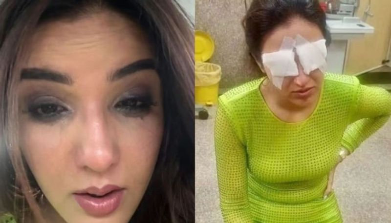 Actress Jasmin Bhasin Cornea Gets Damaged Due To Eye Lenses walked without vision roo