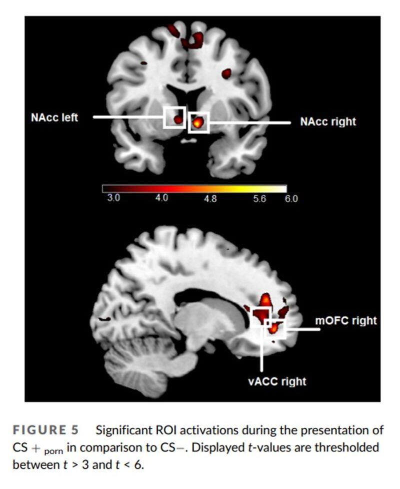Pornography can be more rewarding than gaming or money for men, reveals recent study snt