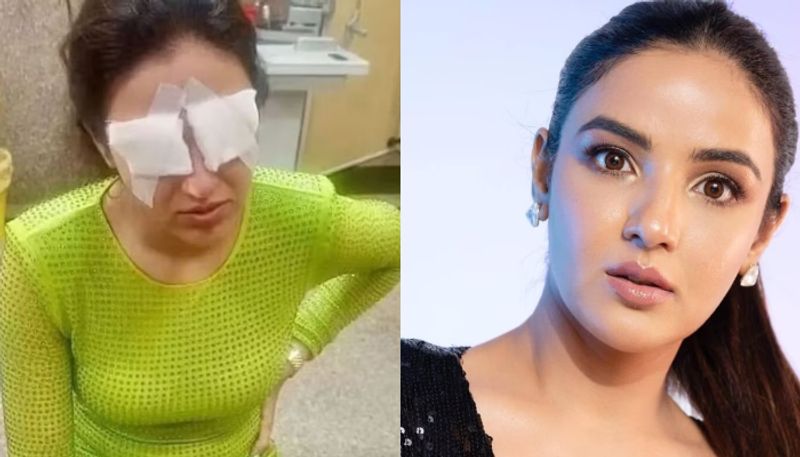 ActorJasmine Bhasin Suffers Corneal Damage