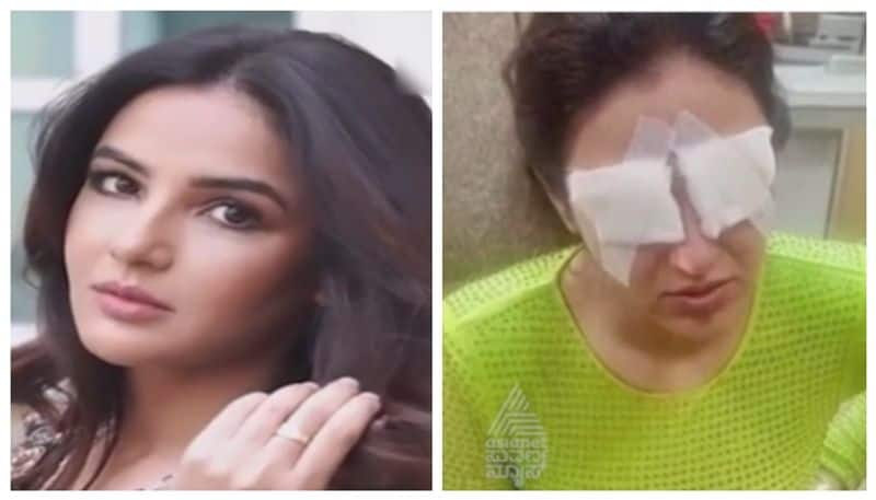 Jasmin Bhasin had problems in eyes nbn