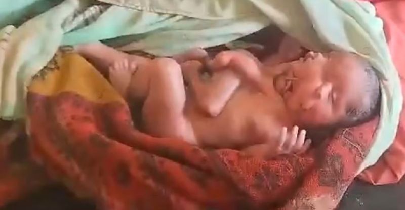 A mother who gave birth to a strange child in sitapur with two bodies, two faces and four legs and four arms akb