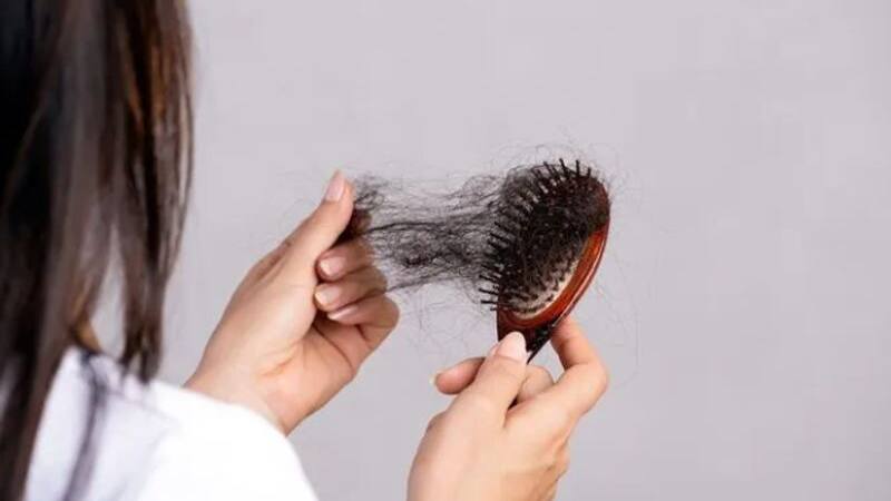 hair loss