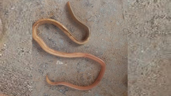 doctors removed 30 cm worm from 30 year old youth s stomach mrq