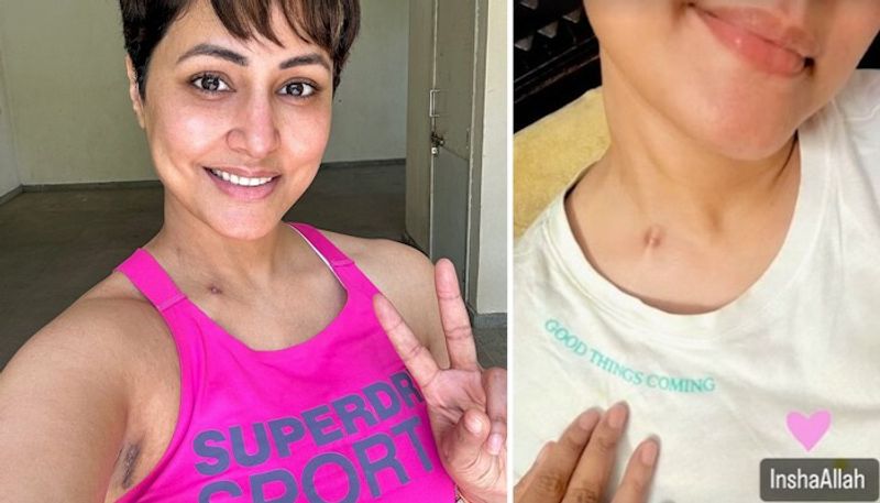 Hina Khan shows off chemotherapy scar following stage 3 breast cancer diagnosis RBA