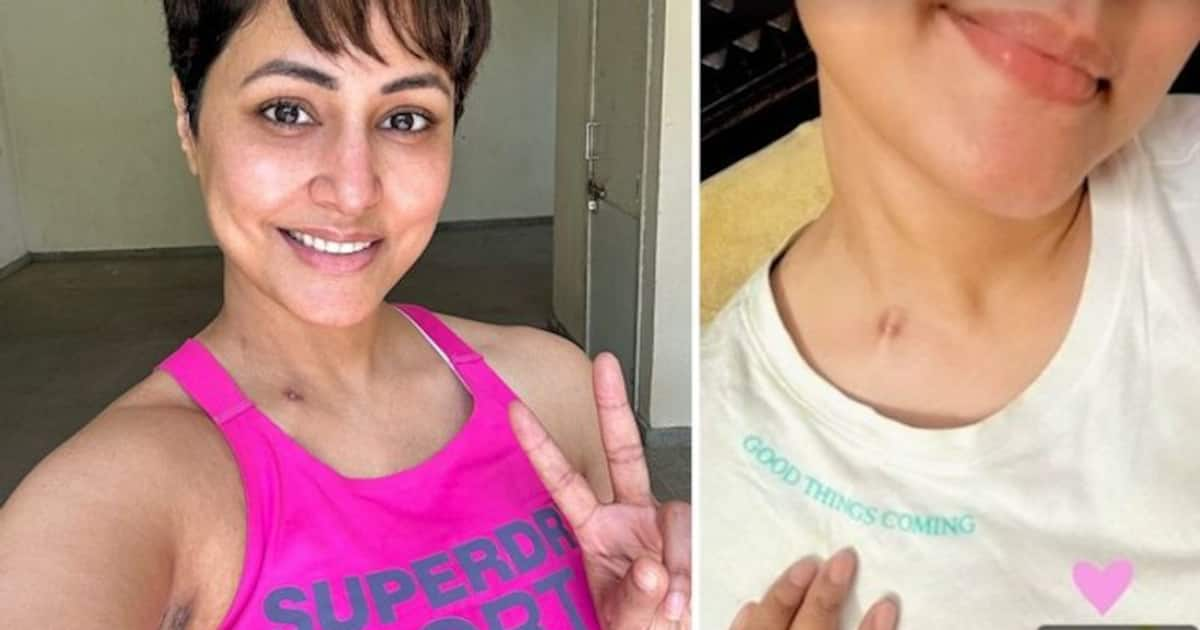 Hina Khan shows off chemotherapy scar following stage 3 breast cancer ...