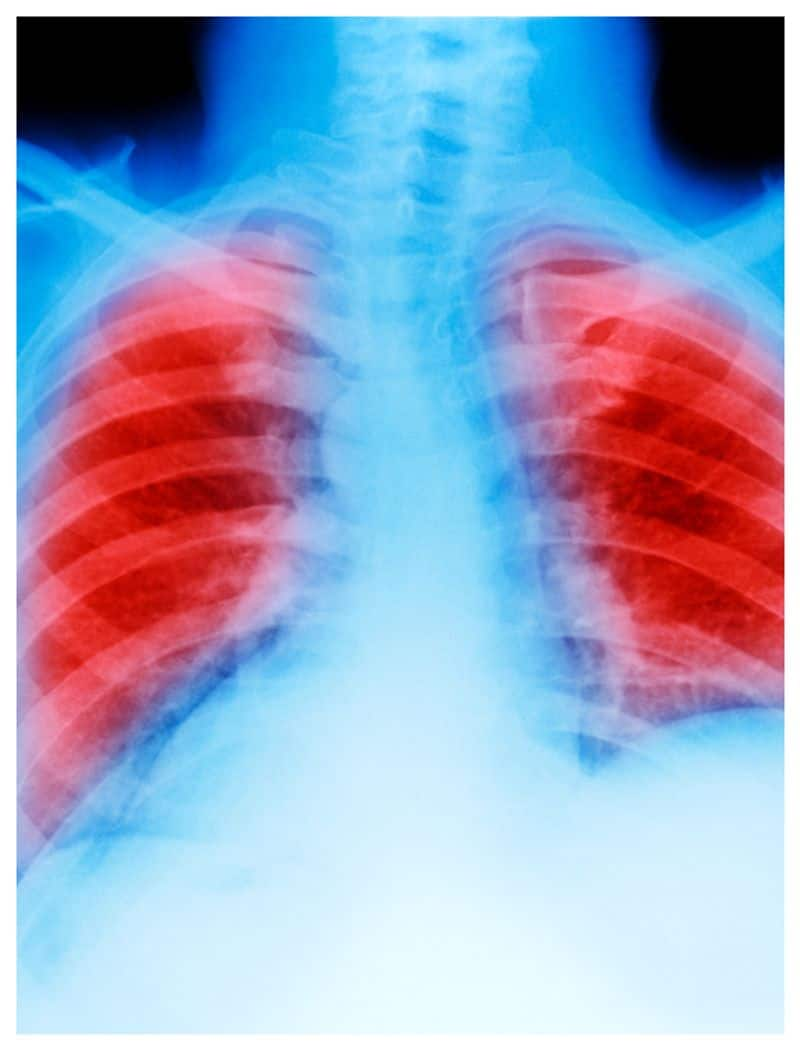 home-lung-cancer-identification-5-seconds-test