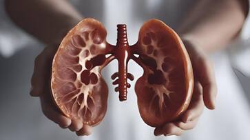 know  common myths and fact related to kidney