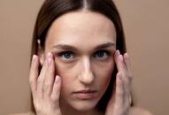 Natural remedies for puffy eyes: Try these easy and effective tips today iwh