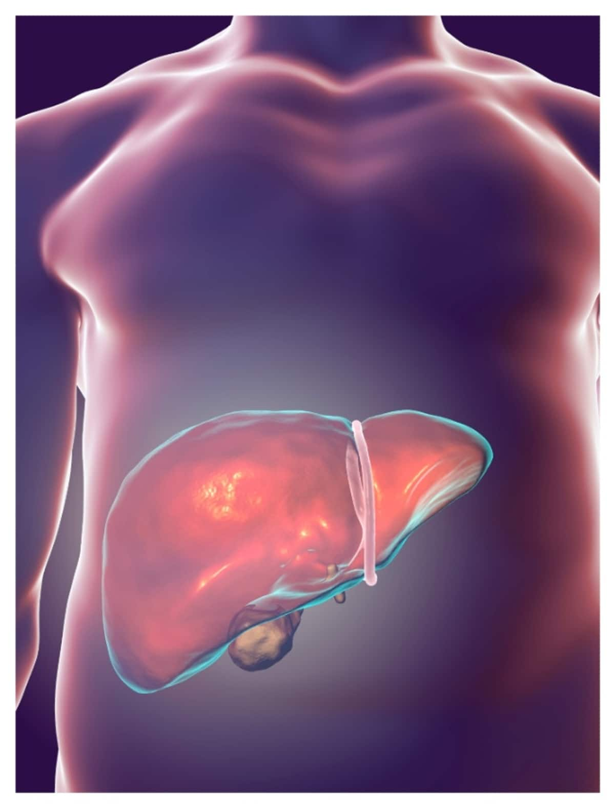 fatty liver patients is increasing in kerala