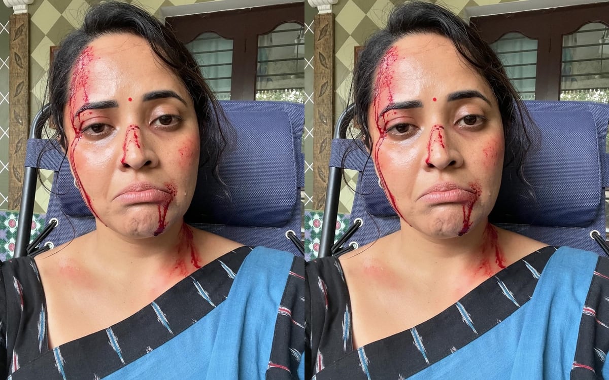 is anasuya bharadwaj attacked by some one her face is bleeding ksr  