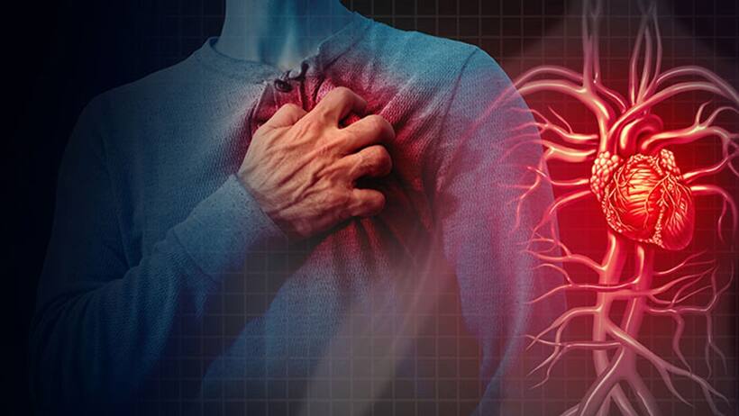 Why intense exercise and lifestyle choices increase heart attack risks for youth