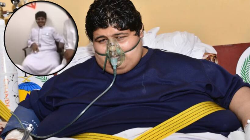 कभी क्रेन से निकाला जाता था इस इंसान को घर से बाहर, अब किया 542 KG weight loss 