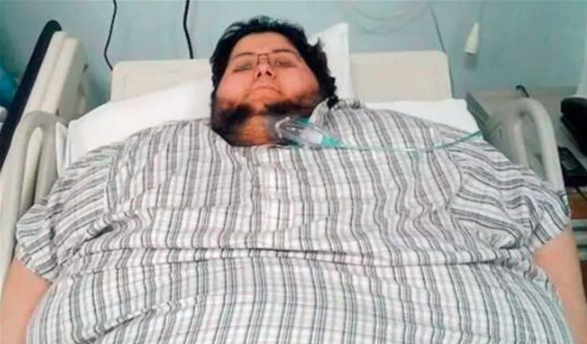 saudi arebias fattest man in the world who lost 542 kg in six months old and new photo viral akb