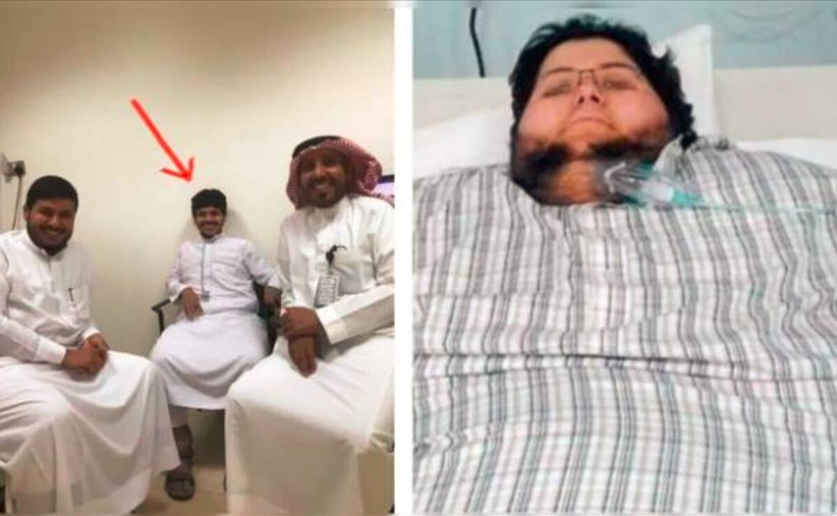 saudi arebias fattest man in the world who lost 542 kg in six months old and new photo viral akb