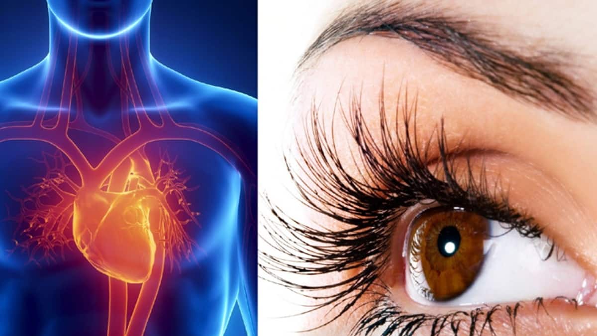 Heart Attack Symptoms appear in your eyes tvk