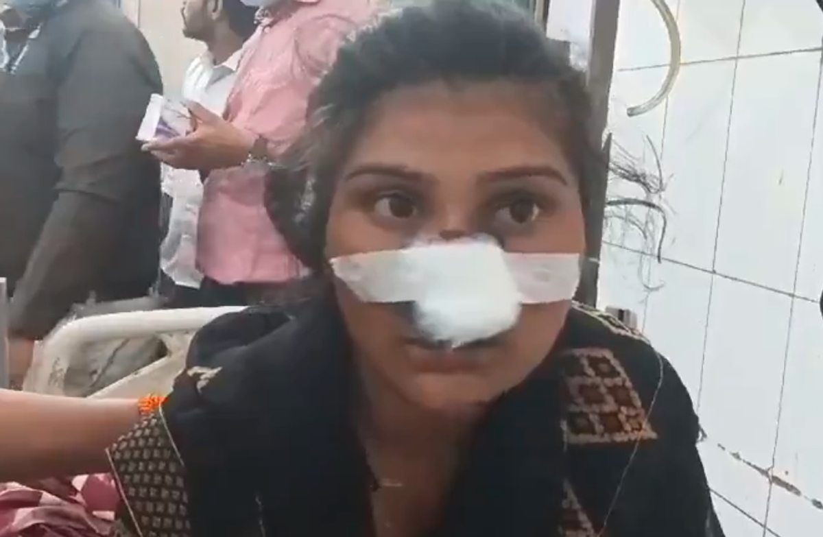 Husband chops wife nose after she plan to visit maternal home and tie rakhi to brother uttar pradesh ckm