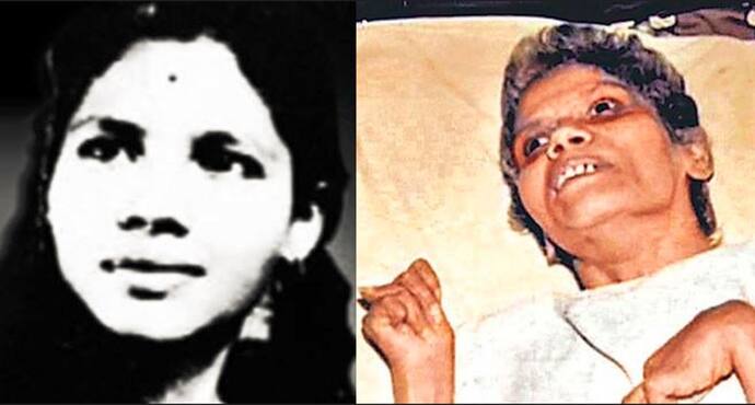 Aruna Shanbaug