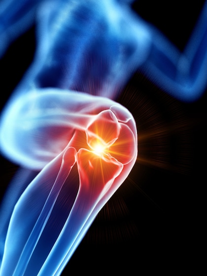 Build stronger bones: Top 6 foods to include in your diet