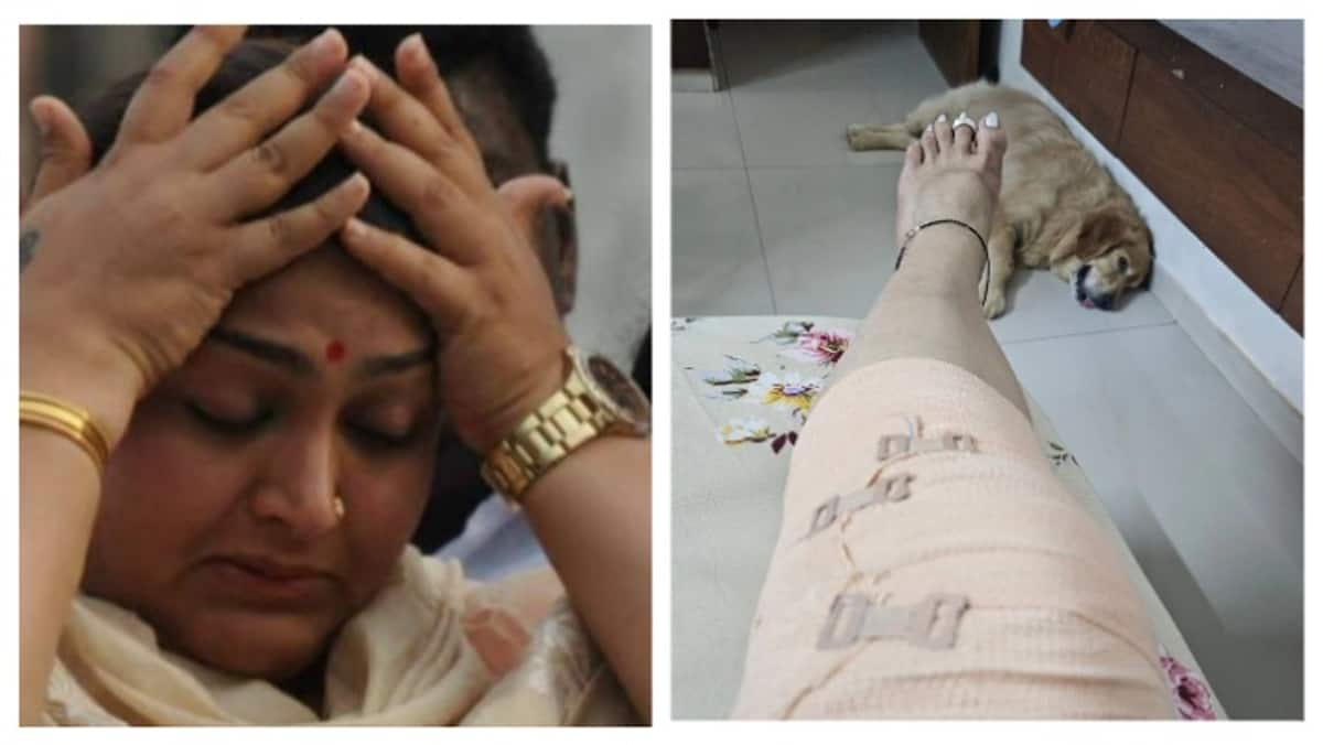 Actress Kushboo Sundar injured shocking photo goes viral mma