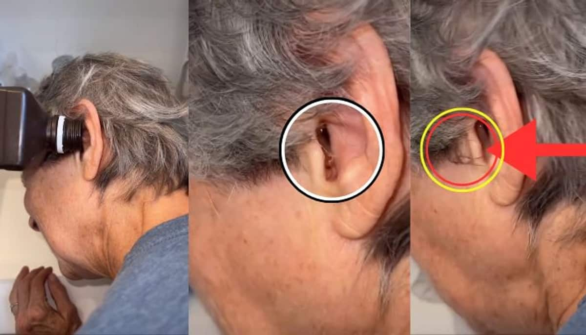 A spider came out of a woman s ear Watch video mrq