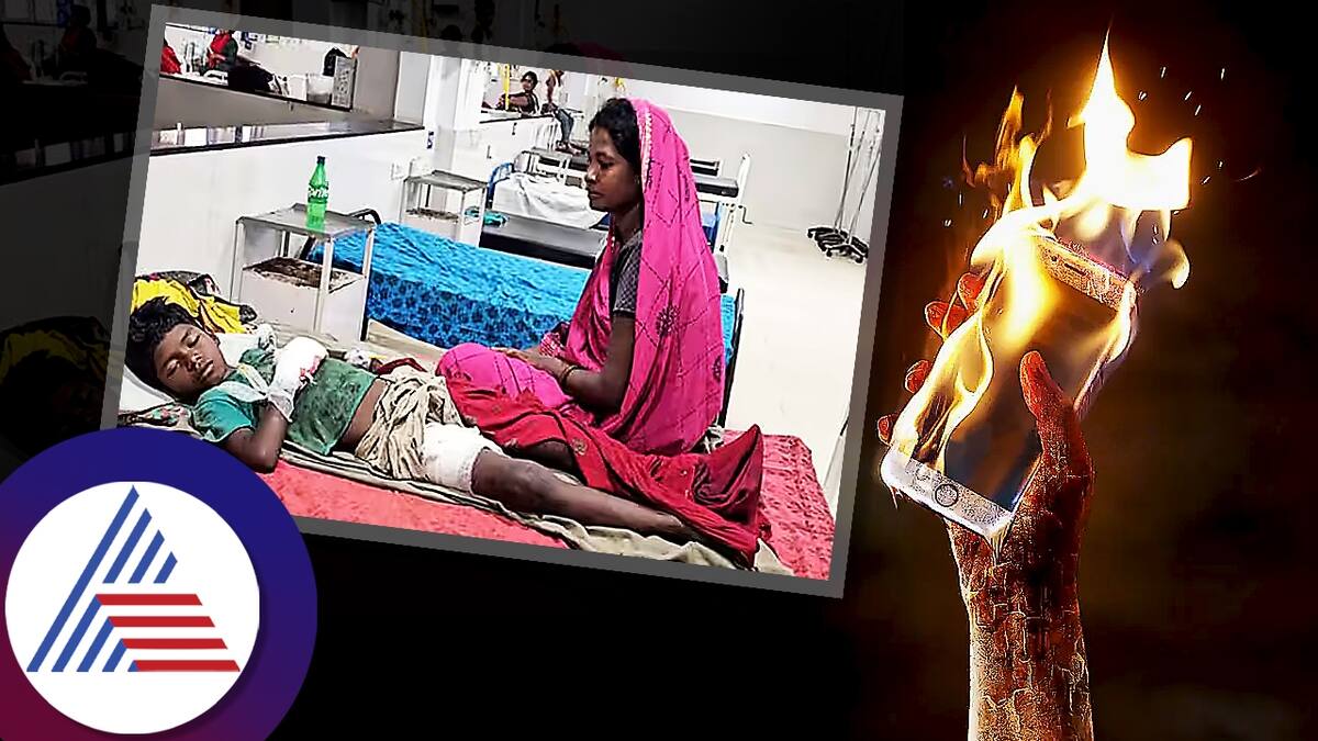 Nine year old boy injured after smartphone explodes in hand while watching cartoon madhya pradesh ckm