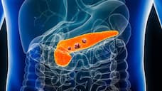 World Pancreatic Cancer Day 2024: Know lifestyle modifications to lower the risk of Pancreatic cancer RBA