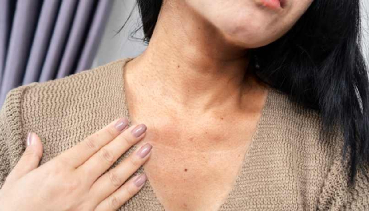 home remedies to get rid of dark neck