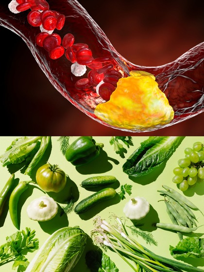 Green Foods to Lower Cholesterol