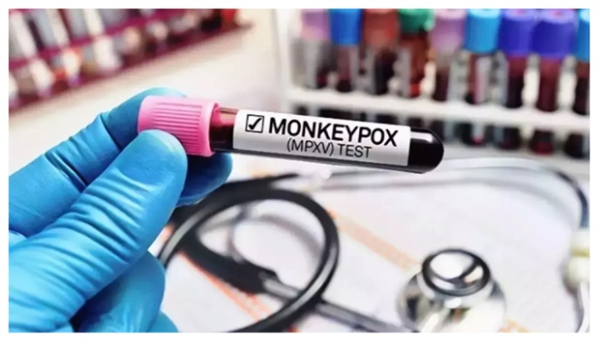 India report first suspected monkeypox case no cause of concern says health ministry ckm