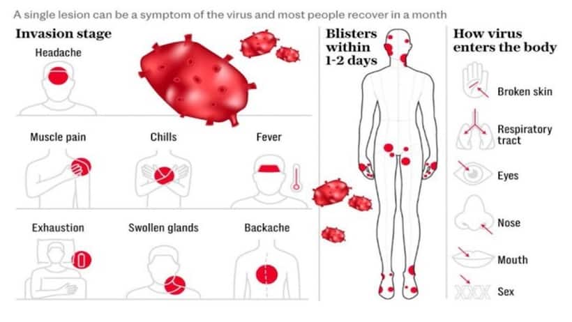 Mpox  और COVID 19 के बीच क्या है अंतर? जानें घातक बीमारी से सुरक्षित रहने के तरीके 