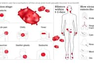 first-mpox-case-in-india-safety-measures-and-differences-from-covid-19