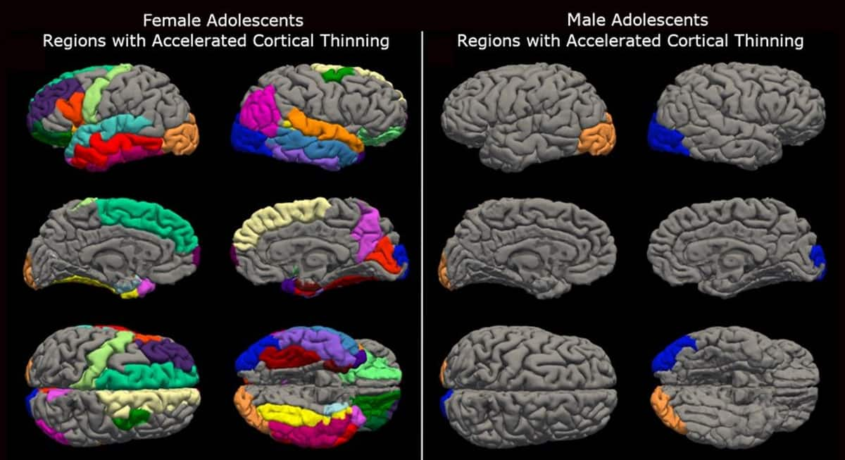 Pandemic fallout: Girls' brains aged faster than boys' during Covid lockdown, new research reveals