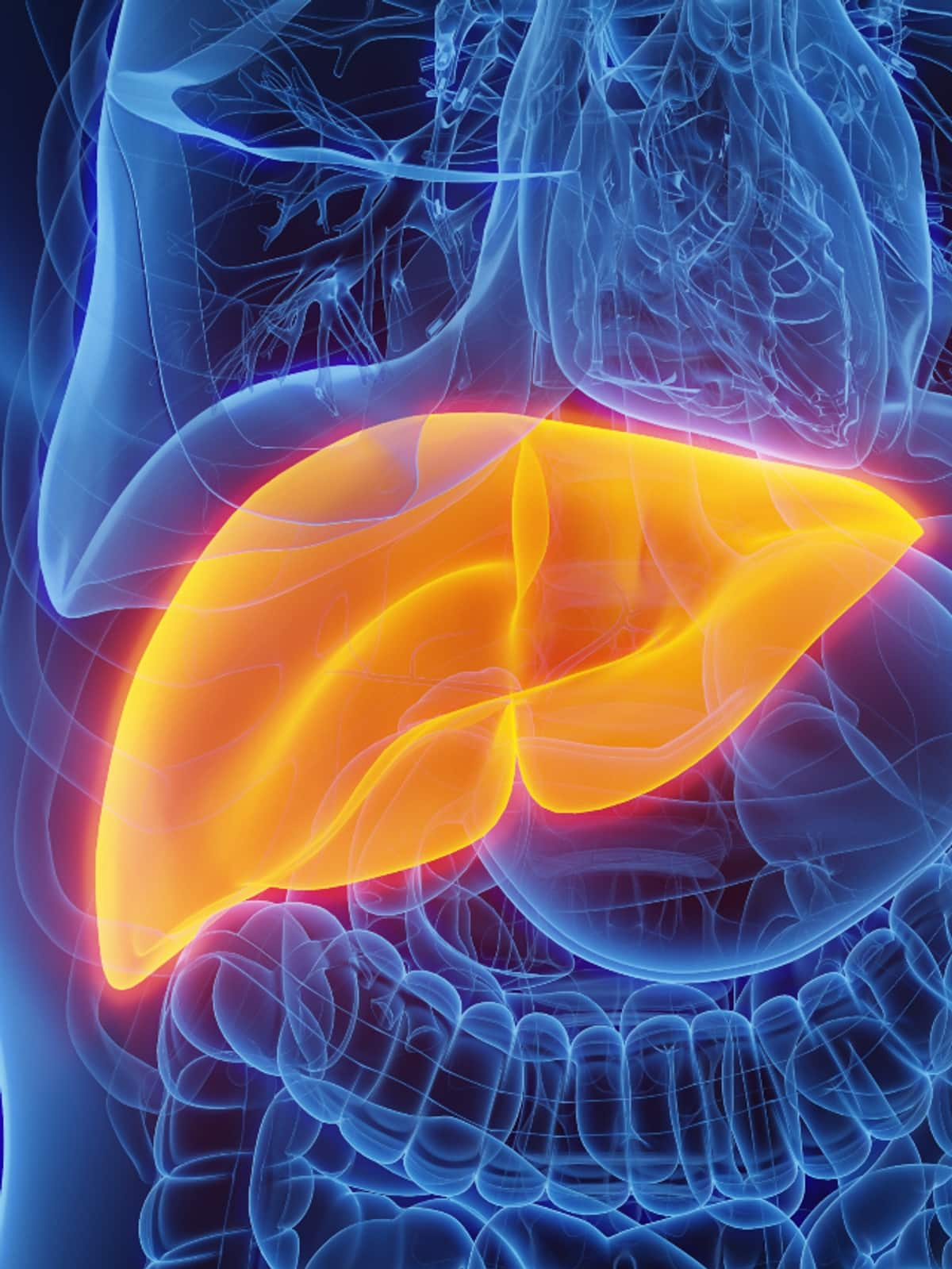 foods you should avoid if you have fatty liver disease 