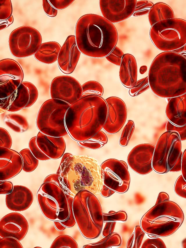 Blood Cancer Early Symptoms: Warning Signs You Shouldnt Ignore