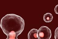 Early signs of blood cancer you should never ignore iwh