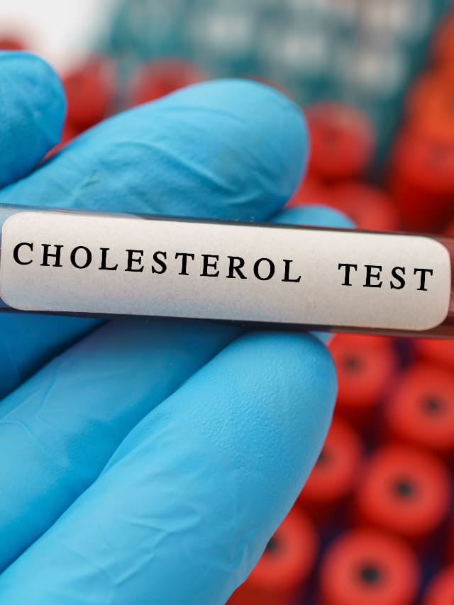 High Cholesterol! Don't ignore these symptoms ATG