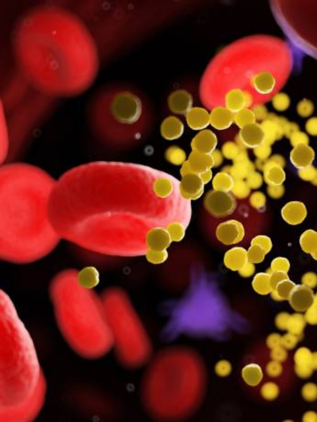 Garlic Magic How to use garlic to effectively reduce cholesterol levels